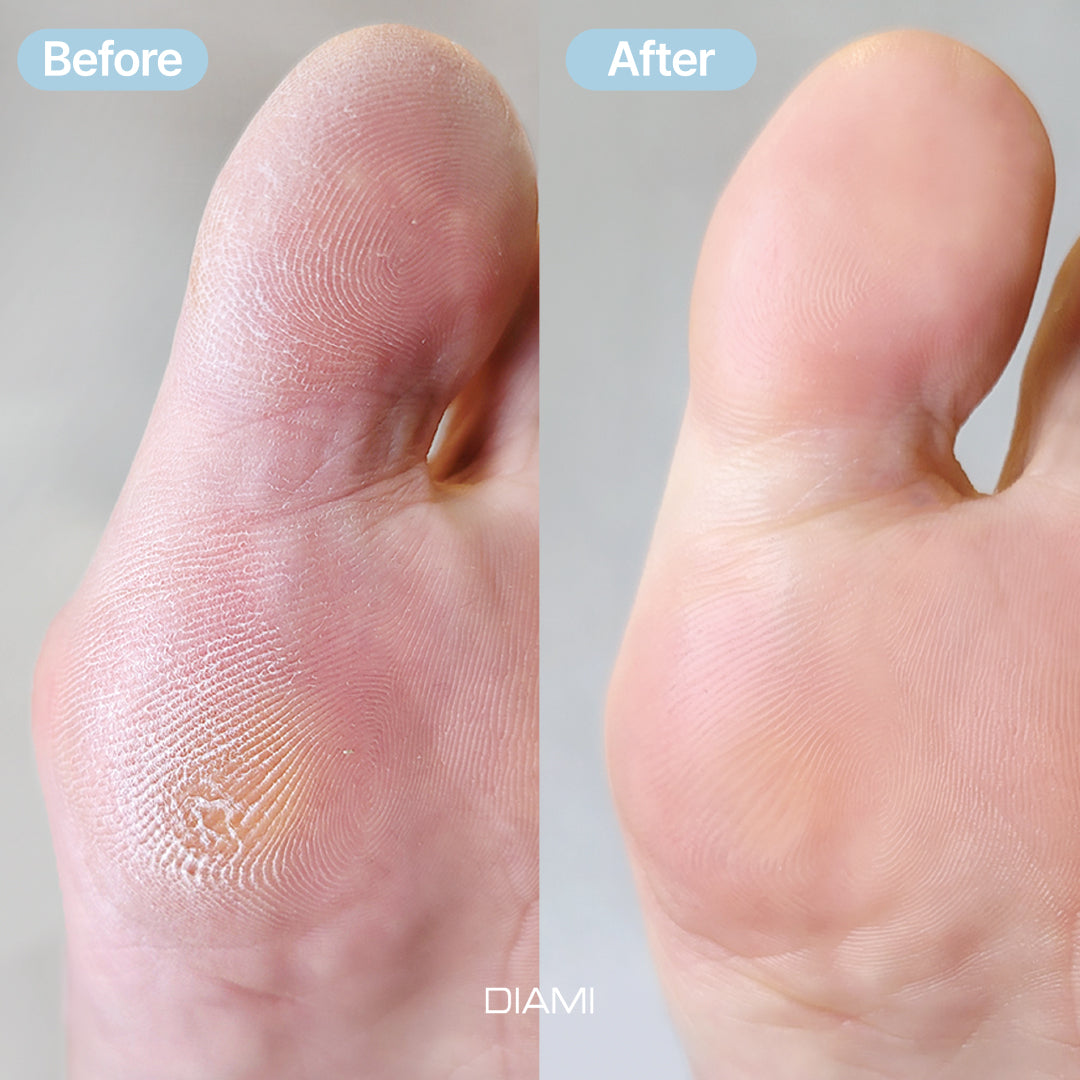 BEAUHAN Speedew Foot Spray (Get free Ultra Fine Pedi File & Refills)